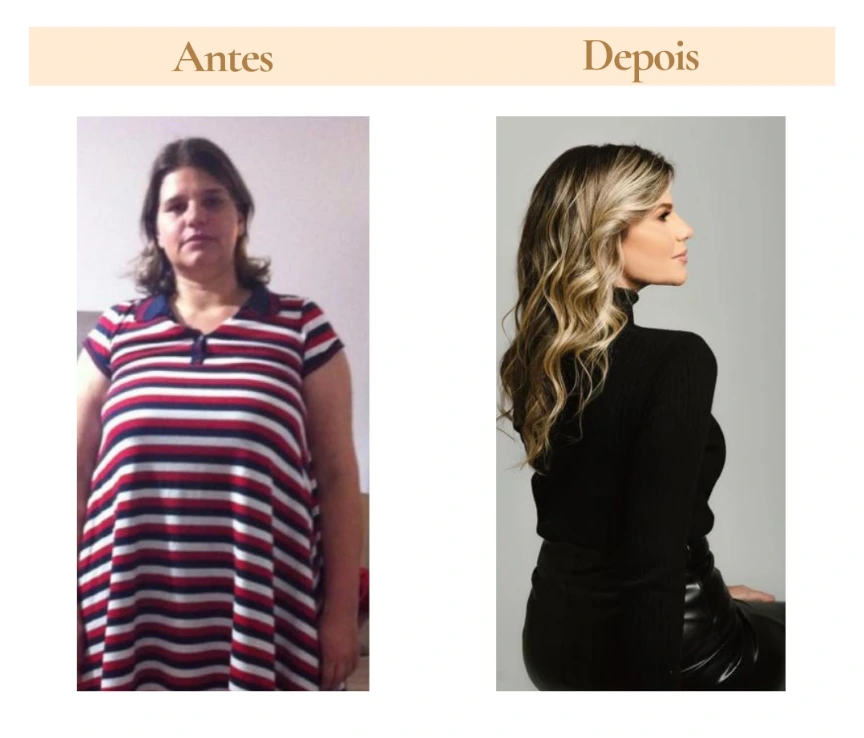 Primeiro comparativo de antes e depois publicado pela Clínica Dra. Karina Cobucci
