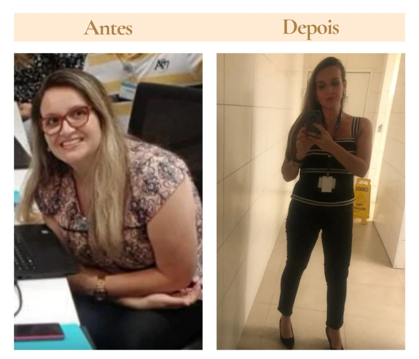 Segundo comparativo de antes e depois publicado pela Clínica Dra. Karina Cobucci
